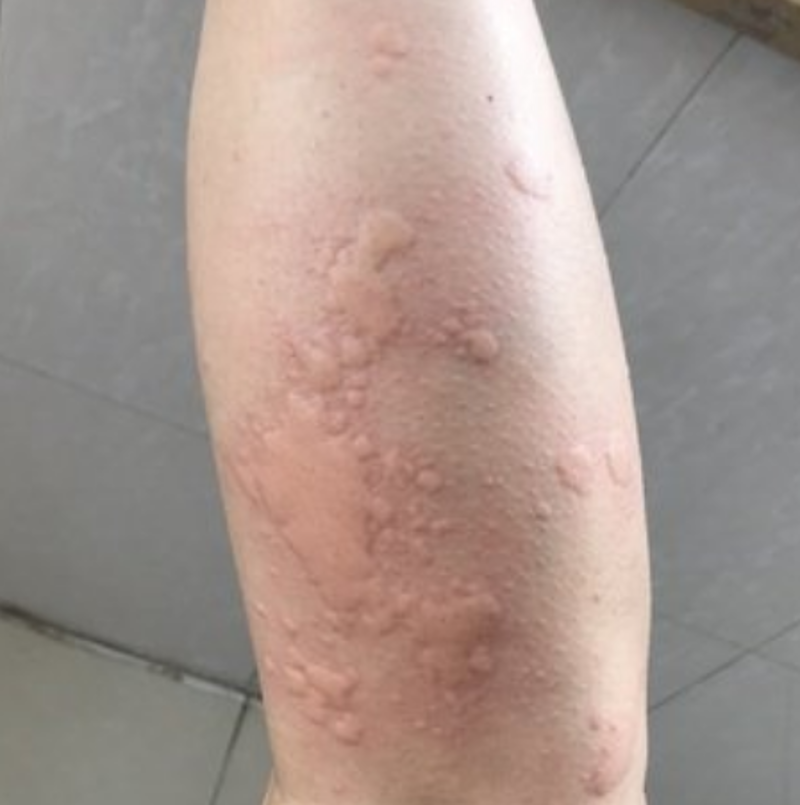 大连皮肤病医院：聚焦皮肤健康前沿