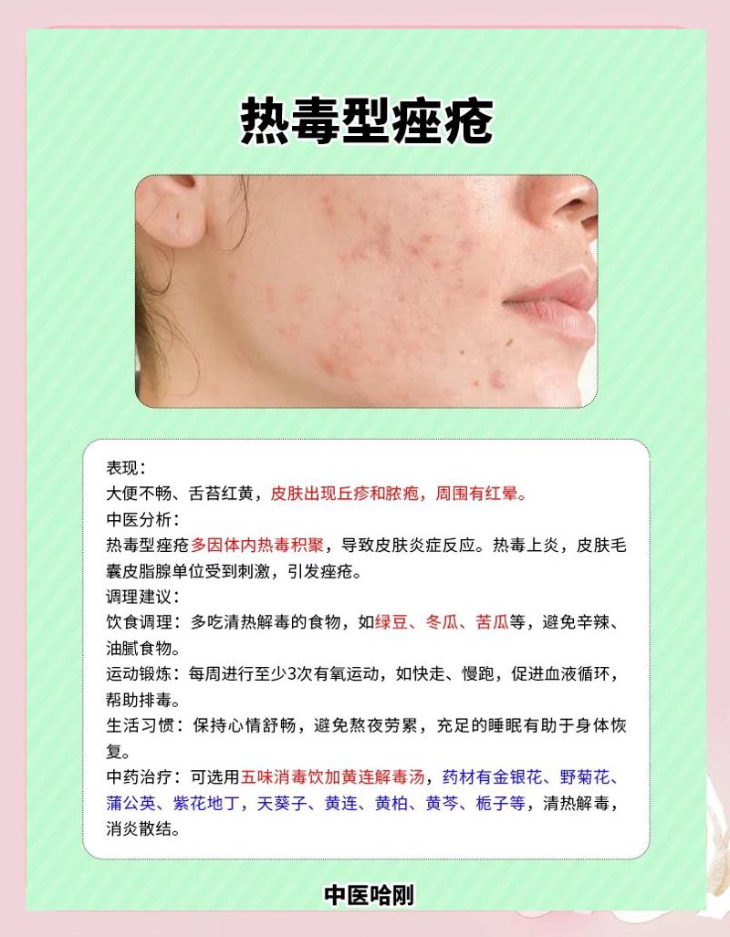 痤疮治疗
