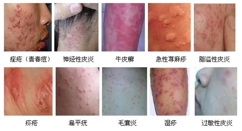 城市角落里的健康守护者：探访西岗区皮肤病诊所