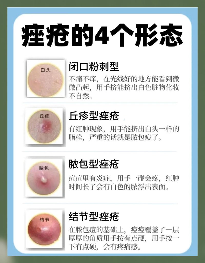 湿疹治疗：探秘背后的科学与温情