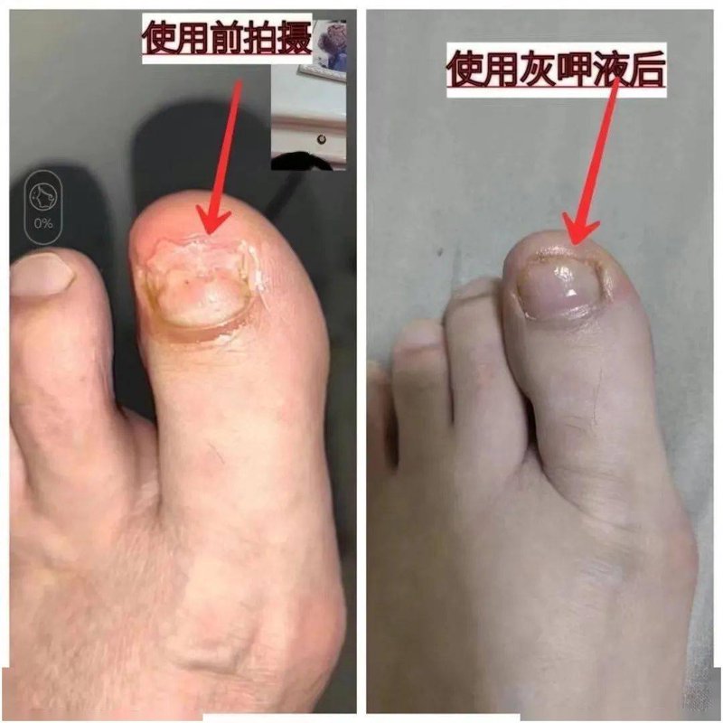 大连皮肤病医院：守护你的肌肤健康
