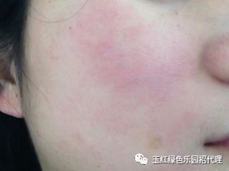 京城皮肤病诊所选购指南